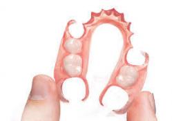 Tcs Flexible Partial Denture From China Dental Lab